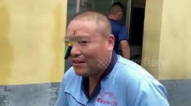 Chinese man lucky to avoid serious injury after fishing hook pierces his forehead