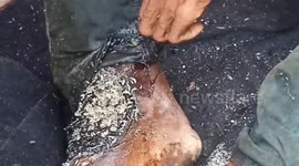 Man infested with maggots in his legs is rescued by an Indian pharmacist and treated in Southern East India.