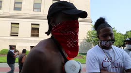 Man who was pepper-sprayed in Kenosha, Wisconsin says pain he felt can't compare what victims of racial injustice deal with