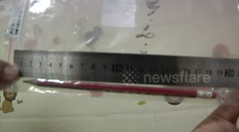 Chinese doctor removes 18-centimetre-long pencil from boy's stomach