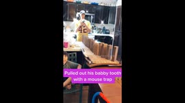 Dad removes kids tooth using a mouse trap