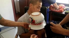 Firefighters free boy's head from spittoon in eastern China