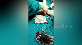 Indian doctors extract metal objects from inside the stomach of an 18-year-old in northern India