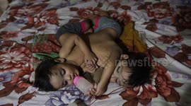 Conjoined twins' surgery deferred amid financial constraints in northern India