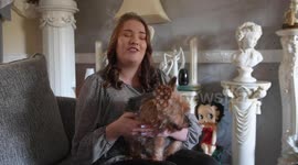 UK woman believes her dog saved her life by 'sniffing out' sepsis after she developed the life-threatening condition from third-degree burns
