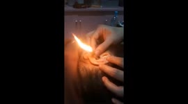 This Vietnamese spa uses smoke to clean ear canals in fiery treatment