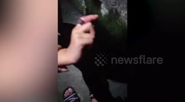 Toddler's finger swells after metal nut used as a toy ring was stuck there for five days