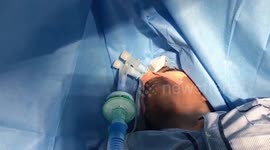 Indian woman chants Hindu scriptures as she undergoes open brain surgery