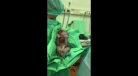 Baby right after C-section, cutest baby