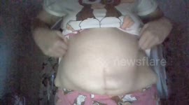 i use to be 20 stone and it may my belly look like is
