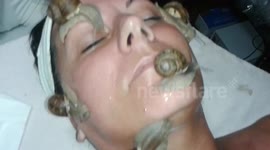 Snail slime facial offered in Serbian beauty salon