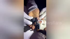 Firemen remove a ring that was stuck on man’s finger for two years