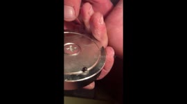 US man removes metal pellet from his foot using magnet in gruesome video