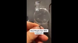 Interpretation Of How People See With Different Eye Conditions