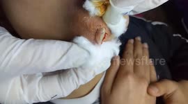 Dermatologist removes giant pimple from Vietnamese man's chin