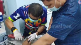 Rescuers help remove ring stuck on Thai man’s finger