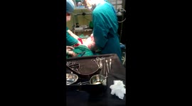 INDIA,Madhya Pradesh (Bhopal) 16 kg tumour removed from 20-yr-old woman's abdomen