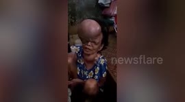 Filipina woman, 63, has tumour growing from forehead as big as a football