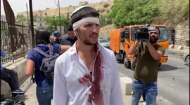 Victim of near-fatal lynch near Lion's Gate in Jerusalem's Old City tells his story