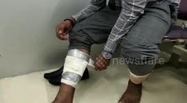 Indian customs officials detain man smuggling gold taped to his ankles