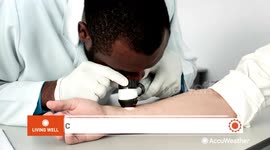 How skin cancer affects people of color