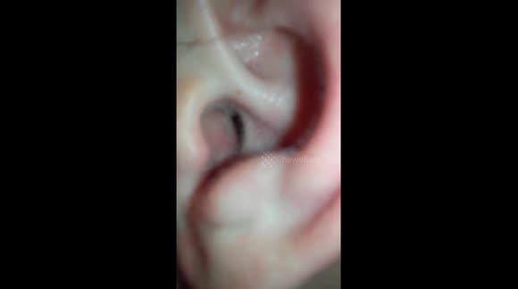 Man finds black widow spider in his ear