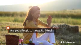Are you allergic to mosquito bites?