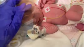 UK woman treated for appendicitis discovers she is actually in LABOUR!