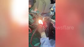 Young woman sings hymn as doctors perform awake brain surgery to remove tumor
