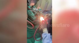 Longer Version_Tumour patient chants hymn as doctors perform open-brain surgery in northern India