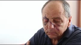 Face reconstruction surgery in Romania