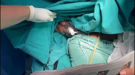 57-year-old Patient Recites Gayatri Mantra as Doctor Removes his Brain Tumor