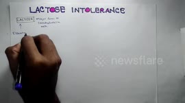 LACTOSE INTOLERANCE : Pathophysiology,Causes,Signs and symptoms,Treatment