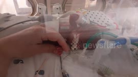 World's most premature baby born reaches his first birthday and learns to crawl