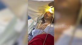 Doctors successfully perform awake craniotomy on man in northern India