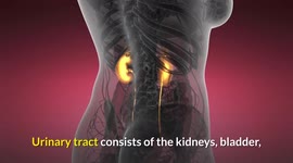 Symptoms Of Kidney Stones |What Are The Most Common Signs & Symptoms Of Kidney Stone Disease?