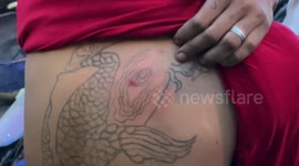 Protester’s face covered in blood after being struck during clash with police