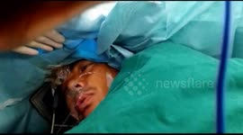 Man talks throughout brain surgery in China