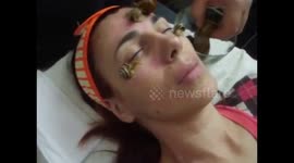 Anti-age facial treatment snails and DermaPen !
