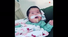 '1.5 Weeks Old baby with down syndrome interacts with family members via video'