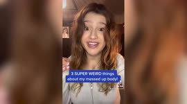 Meet the young woman who can see her heart beat through her chest