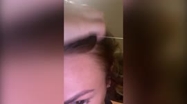 Reality TV star opens up about the harsh reality of living with alopecia