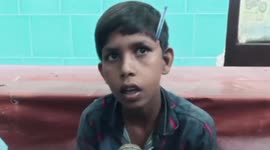 Young boy taken to hospital in eastern India after pen pierces his skull