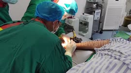 Firemen remove rings from woman’s severely swollen fingers in China