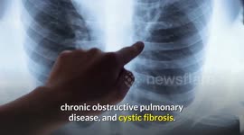 Cleanse & Detox Your Lungs Naturally | 6 Tips To Keep Your Lungs Clean & Healthy | Lung Cleansing