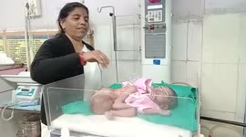 Woman gives birth to double-headed girl in central India