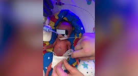 Teenage mum gives birth to tot believed to be the UK's smallest premature baby