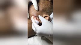 Horrifying moment enormous zit on man's face is popped