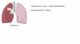 Lung Cancer :- Signs & Symptoms |Patient Education