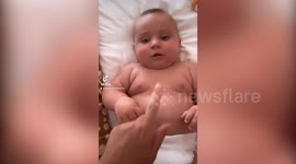This 1-year-old is so large for his age that he has to wear ADULT NAPPIES
